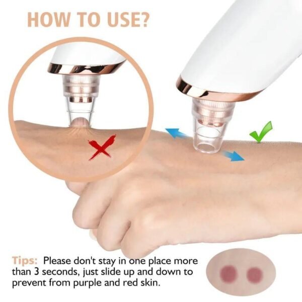 Remove Impurities - 1 Pcs Black Head Remover for Clean and Clear Skin
